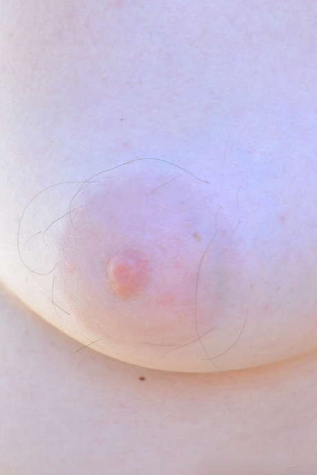 facial fat grafting uk free nude img